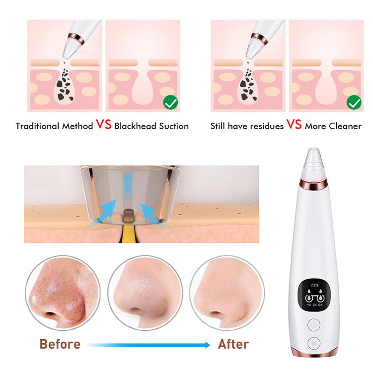Removal Blackhead Horny Acne Facial Beauty Device
